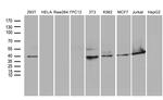 WDR77 Antibody in Western Blot (WB)