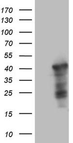 WDR92 Antibody in Western Blot (WB)