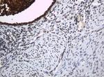 WFDC2 Antibody in Immunohistochemistry (Paraffin) (IHC (P))