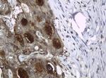 WFDC2 Antibody in Immunohistochemistry (Paraffin) (IHC (P))