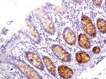 WFDC2 Antibody in Immunohistochemistry (Paraffin) (IHC (P))