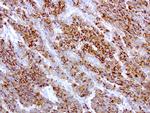 WFDC2 Antibody in Immunohistochemistry (Paraffin) (IHC (P))