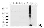 WFDC2 Antibody in Western Blot (WB)