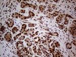 WHSC1L1 Antibody in Immunohistochemistry (Paraffin) (IHC (P))