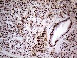 WHSC1L1 Antibody in Immunohistochemistry (Paraffin) (IHC (P))