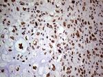 WHSC1L1 Antibody in Immunohistochemistry (Paraffin) (IHC (P))