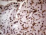 WHSC1L1 Antibody in Immunohistochemistry (Paraffin) (IHC (P))