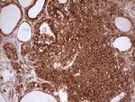 WIBG Antibody in Immunohistochemistry (Paraffin) (IHC (P))