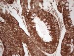 WIBG Antibody in Immunohistochemistry (Paraffin) (IHC (P))