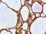 WIBG Antibody in Immunohistochemistry (Paraffin) (IHC (P))