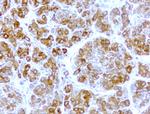 WIBG Antibody in Immunohistochemistry (Paraffin) (IHC (P))