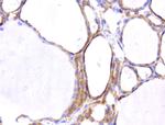 WIBG Antibody in Immunohistochemistry (Paraffin) (IHC (P))