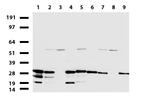 WIBG Antibody in Western Blot (WB)