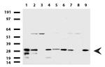 WIBG Antibody in Western Blot (WB)