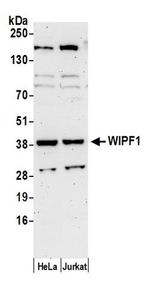 WIPF1 Antibody in Western Blot (WB)