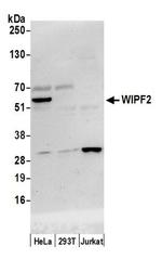 WIPF2/WIRE Antibody in Western Blot (WB)