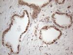 WTAP Antibody in Immunohistochemistry (Paraffin) (IHC (P))