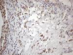 WTAP Antibody in Immunohistochemistry (Paraffin) (IHC (P))