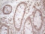 WTAP Antibody in Immunohistochemistry (Paraffin) (IHC (P))