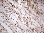 WTAP Antibody in Immunohistochemistry (Paraffin) (IHC (P))