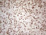 WTAP Antibody in Immunohistochemistry (Paraffin) (IHC (P))