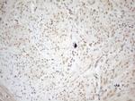 WTAP Antibody in Immunohistochemistry (Paraffin) (IHC (P))