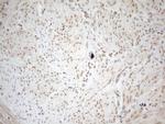 WTAP Antibody in Immunohistochemistry (Paraffin) (IHC (P))