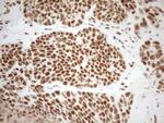 WTAP Antibody in Immunohistochemistry (Paraffin) (IHC (P))