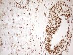 WTAP Antibody in Immunohistochemistry (Paraffin) (IHC (P))