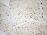 WTAP Antibody in Immunohistochemistry (Paraffin) (IHC (P))