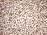 WTAP Antibody in Immunohistochemistry (Paraffin) (IHC (P))