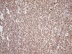 WTAP Antibody in Immunohistochemistry (Paraffin) (IHC (P))