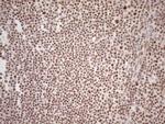 WTAP Antibody in Immunohistochemistry (Paraffin) (IHC (P))