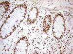 WTAP Antibody in Immunohistochemistry (Paraffin) (IHC (P))