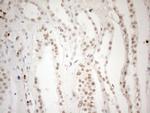 WTAP Antibody in Immunohistochemistry (Paraffin) (IHC (P))