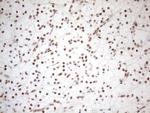 WTAP Antibody in Immunohistochemistry (Paraffin) (IHC (P))