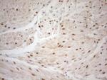 WTAP Antibody in Immunohistochemistry (Paraffin) (IHC (P))