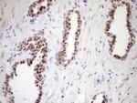 WTAP Antibody in Immunohistochemistry (Paraffin) (IHC (P))