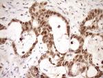 WTAP Antibody in Immunohistochemistry (Paraffin) (IHC (P))