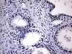 WTAP Antibody in Immunohistochemistry (Paraffin) (IHC (P))