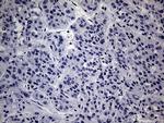 WTAP Antibody in Immunohistochemistry (Paraffin) (IHC (P))