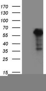 WTAP Antibody in Western Blot (WB)