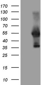 WTAP Antibody in Western Blot (WB)