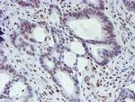 WWTR1 Antibody in Immunohistochemistry (Paraffin) (IHC (P))