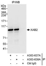 XAB2 Antibody in Immunoprecipitation (IP)