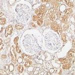 XIAP Antibody in Immunohistochemistry (Paraffin) (IHC (P))