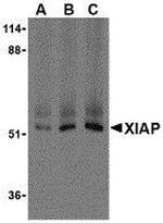 XIAP Antibody in Western Blot (WB)