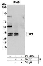 XPA Antibody in Western Blot (WB)