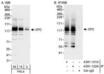 XPC Antibody in Western Blot (WB)