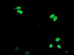 XPF Antibody in Immunocytochemistry (ICC/IF)